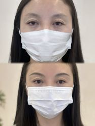 点击看大图 -杨益美学·野生眉半永久纹眉发际线