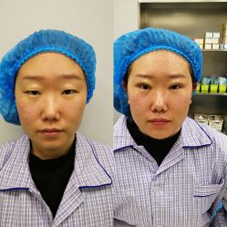 -紫洁俪方（北京）医疗美容