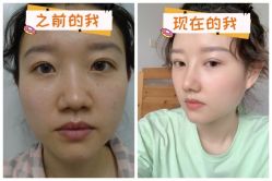 -素美医疗美容·西南眼鼻整形·修复基地