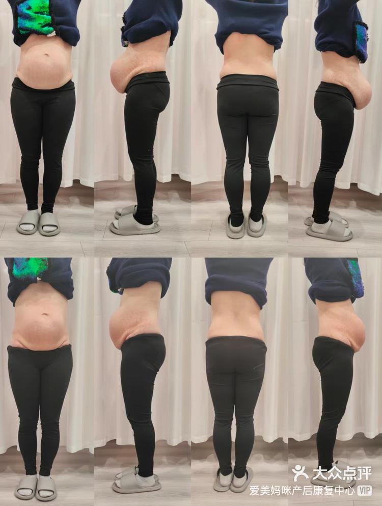 悬垂腹,不是胖的