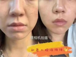 -LUNA皮相美·骨相美高级美感