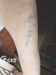 -雲艺刺青·洗纹身