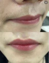 -薇兰专业脱毛连锁机构