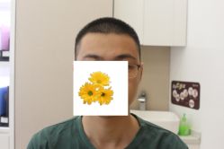 -大麦微针植发丨全国连锁