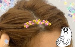 -大麦微针植发全国连锁