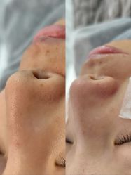 -skin79皮肤管理中心