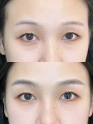 点击看大图 -杨益美学·野生眉半永久纹眉发际线