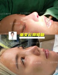 -北京米扬丽格医疗美容·联合丽格鼻整形中心