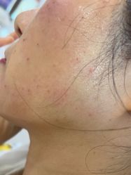 -广州曙光医学美容医院