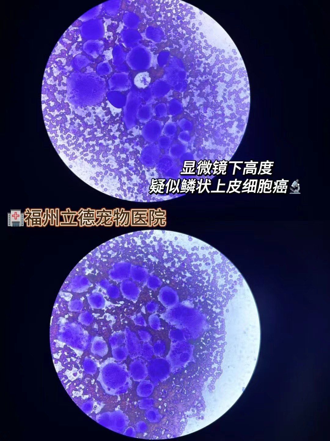 lily带你一起探索鳞状上皮细胞癌小知识🔬:
🐾鳞状上皮细胞癌