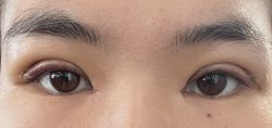 点击看大图 -Yestar艺星整形美容医院