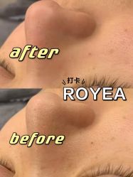 -ROYEA茹彦祛痘·问题肌肤修护中心