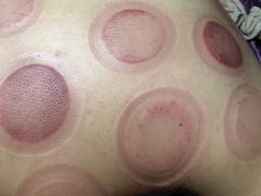 -沈师傅盲人按摩工作室(密三小区店)