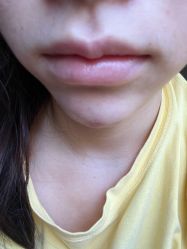 -深圳春天阳光医院·轮廓抗衰中心