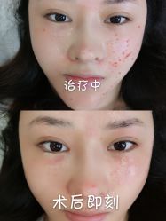 -杭州医巢医疗美容