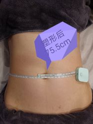 -歌曼丽草本减重