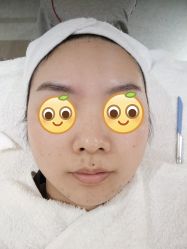 体验前-深圳原色医疗美容