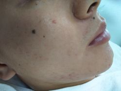 -痘博士北京·全国连锁祛痘机构