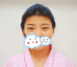 体验前-圣嘉新医疗美容医院