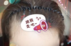 -大麦微针植发全国连锁