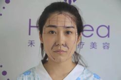 -禾美嘉医疗美容