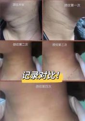 -天津健丽·去眼袋医疗美容机构