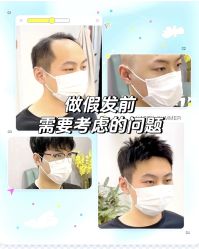 -唐风采假发补发定制