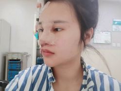 -成都西区医院整形美容