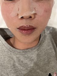 体验后-BR光电保养