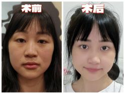 -素美医疗美容·西南眼鼻整形·修复基地
