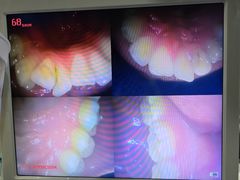 -土豆口腔(凤凰北总店)