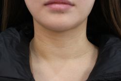 -丰联丽格医疗美容·联合丽格眼整形中心