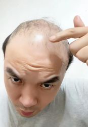 -唐风采假发补发定制