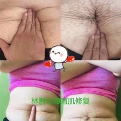 点击看大图 -Dr.林醫生产后修复·配方产康店(南京大厂店)