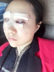 点击看大图 体验后-鑫元辰医疗美容整形