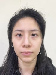 体验前-Yestar杭州艺星医疗美容医院