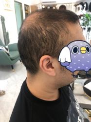 -发饰美男士增发补发假发定制店