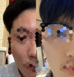 体验后-美瑞莎创美医疗美容