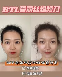 -MOE BEAUTY.皮肤管理中心