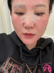 -海涛医疗美容·面部抗衰·注射美鼻