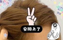 -大麦微针植发全国连锁