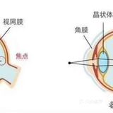 老花眼正常吗？