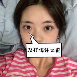 -广州健丽·去眼袋医疗美容机构