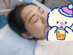 体验后-郡艺医疗美容·微整·眼鼻吸脂