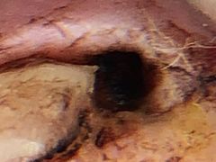 -新甲连锁灰指甲·甲沟炎·鸡眼(黑龙江路店)