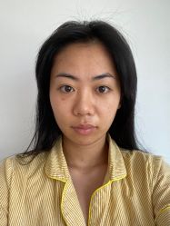 -成都西区医院整形美容
