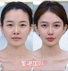 -星港国际·Skin皮肤专研·皮肤管理