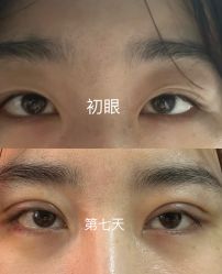 -八大处整形