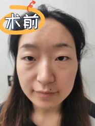 -素美医疗美容·西南眼鼻整形·修复基地