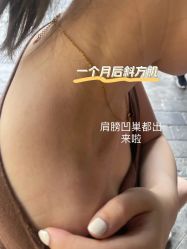 -成都艾特他整形外科医院